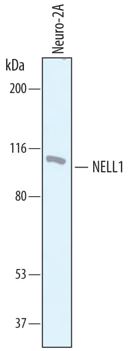 Detection of Mouse NELL1 antibody by Western Blot.