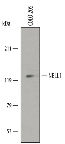 Detection of Human NELL1 antibody by Western Blot.