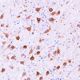 NETO1 antibody in Human Prostate by Immunohistochemistry (IHC-P).