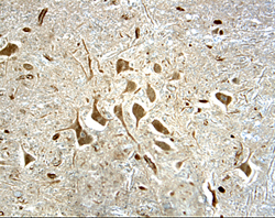 NF-L antibody in Human Spinal Cord by Immunohistochemistry (IHC-P).