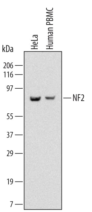 Detection of Human NF2/Merlin antibody by Western Blot.