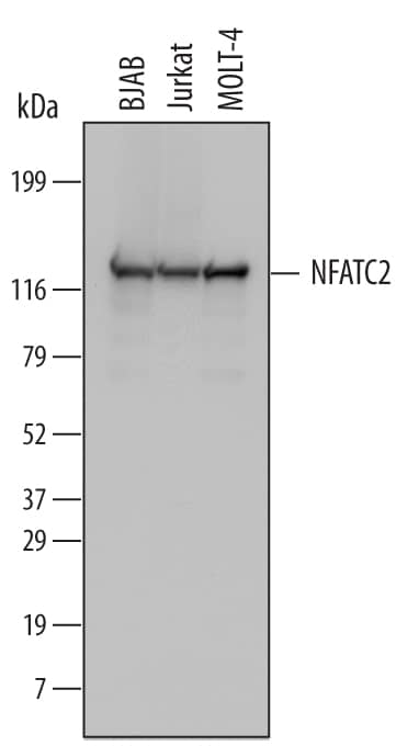 Detection of Human NFATC2 antibody by Western Blot.