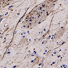 NF-H antibody in Human Brain by Immunohistochemistry (IHC-P).