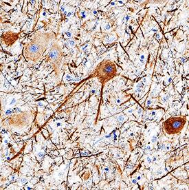 NF-L antibody in Human Brain by Immunohistochemistry (IHC-P).