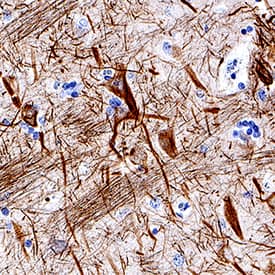 NF-L antibody in Human Brain by Immunohistochemistry (IHC-P).
