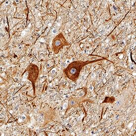 NF-L antibody in Human Brain by Immunohistochemistry (IHC-P).