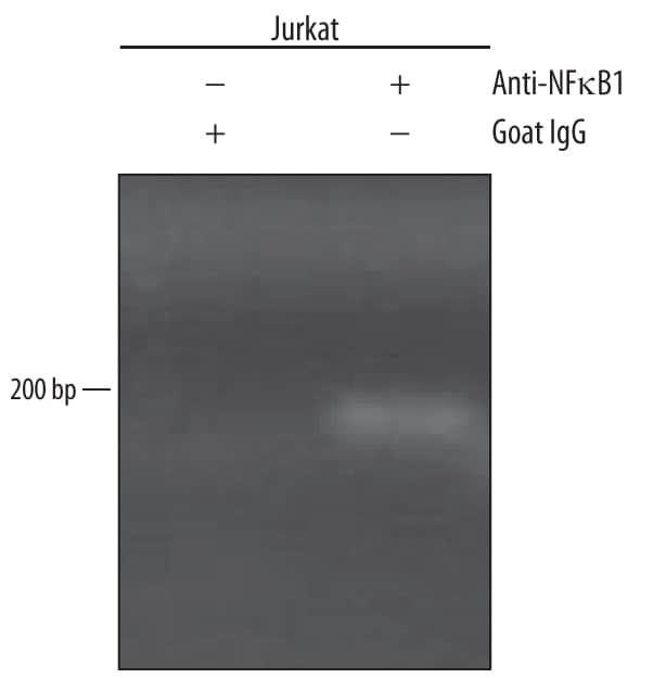 Detection of NF?B1-regulated Genes antibody by Chromatin Immunoprecipitation.