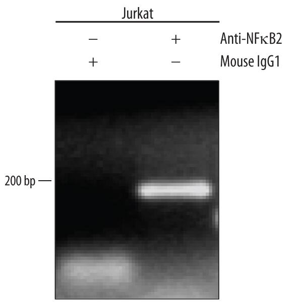 Detection of NF?B2-regulated Genes antibody by Chromatin Immunoprecipitation.