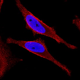 NF?B2 antibody in HeLa Human Cell Line by Immunocytochemistry (ICC).