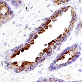 NGFRAP1/BEX3 antibody in Human Prostate by Immunohistochemistry (IHC-P).