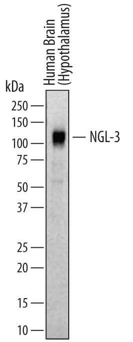 Detection of Human NGL-3/LRRC4B antibody by Western Blot.