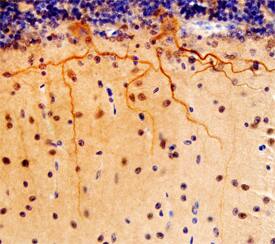 NGL-3/LRRC4B antibody in Human Brain by Immunohistochemistry (IHC-P).