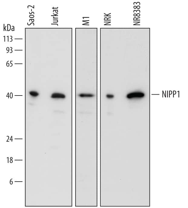 Detection of Human, Mouse, and Rat NIPP1 antibody by Western Blot.