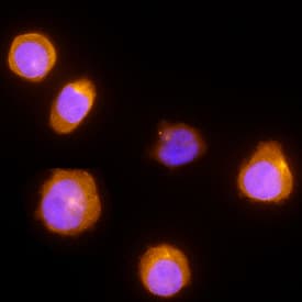 NK1R antibody in THP-1 Human Cell Line by Immunocytochemistry (ICC).