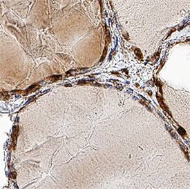 TTF-1/NKX2-1 antibody in Human Thyroid by Immunohistochemistry (IHC-P).