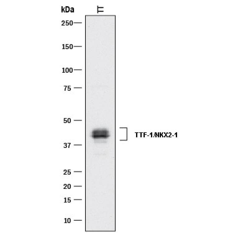 Detection of Human TTF-1/NKX2-1 antibody by Western Blot.