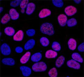 NKX2 by Immunocytochemistry (ICC).2 antibody in A673 Human Cell Line by Immunocytochemistry (ICC).