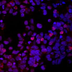 NKX2 by Immunocytochemistry (ICC).2 antibody in Rat Cortical Stem Cells by Immunocytochemistry (ICC).