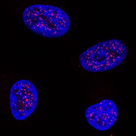 TTF-1/NKX2-1 antibody in A549 Human Cell Line by Immunocytochemistry (ICC).