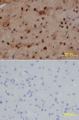 NKX2 by Immunohistochemistry (IHC-P).5 antibody in Human Heart by Immunohistochemistry (IHC-P).