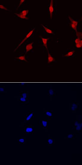 NKX3 by Immunocytochemistry (ICC).1 antibody in LNCaP Human Cell Line by Immunocytochemistry (ICC).