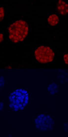 NKX6 by Immunocytochemistry (ICC).1 antibody in  betaTC-6 Mouse Cell Line by Immunocytochemistry (ICC).