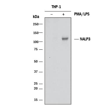 Detection of Human NLRP3/NALP3 antibody by Western Blot.