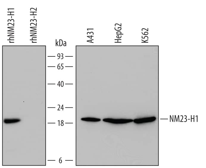 Detection of Human NM23-H1 antibody by Western Blot.