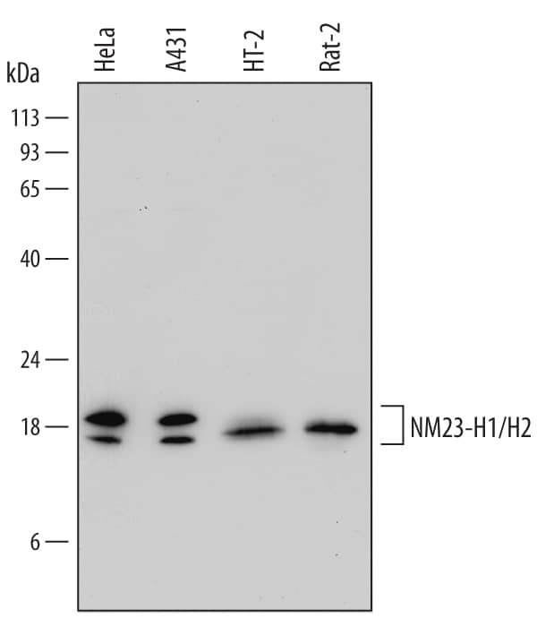 Detection of Human, Mouse, and Rat NM23-H1/H2 antibody by Western Blot.