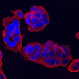 NM23-H2 antibody in MCF-7 Human Cell Line by Immunocytochemistry (ICC).