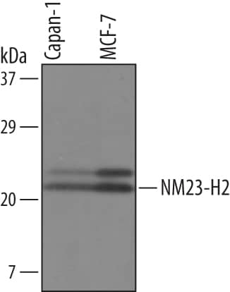 Detection of Human NM23-H2 antibody by Western Blot.