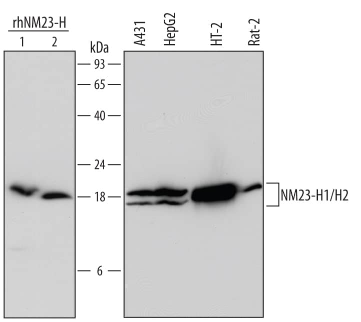 Detection of Human, Mouse, and Rat NM23-H1/H2 antibody by Western Blot.