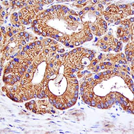 NOV/CCN3 antibody in Human Prostate by Immunohistochemistry (IHC-P).