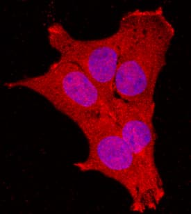 NRAGE antibody in C2C12 Mouse Cell Line by Immunocytochemistry (ICC).