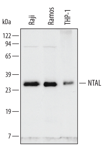 Detection of Human NTAL antibody by Western Blot.