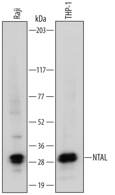 Detection of Human NTAL antibody by Western Blot.