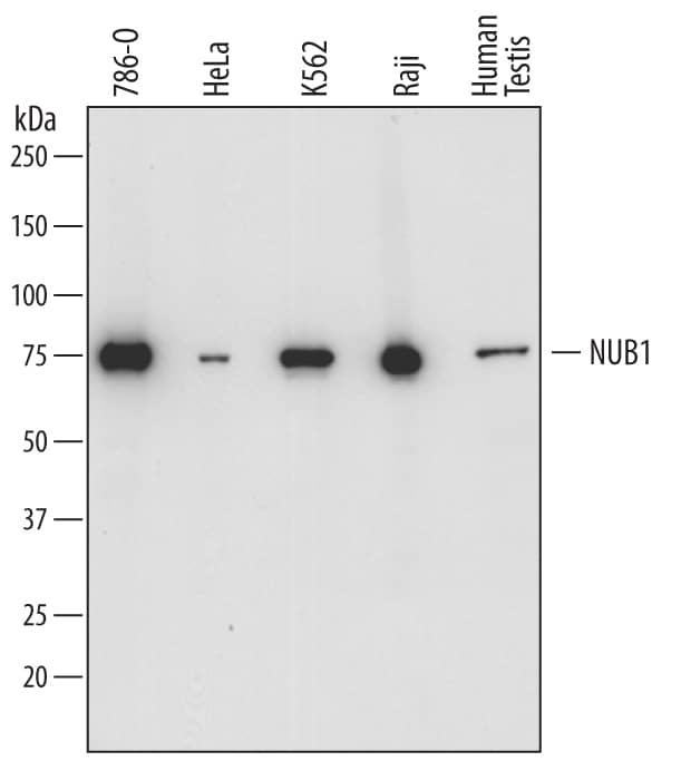 Detection of Human NUB1 antibody by Western Blot.