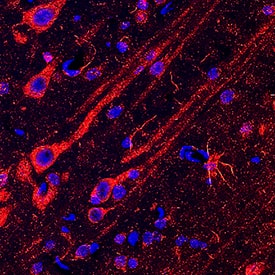 N-WASP antibody in Rat Brain Tissue by Immunohistochemistry (IHC-Fr).