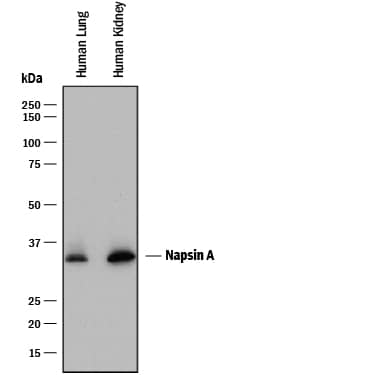 Detection of Human Napsin A antibody by Western Blot.