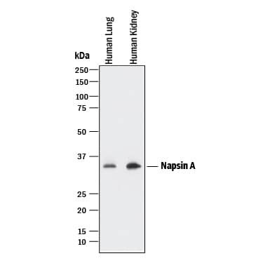 Detection of Human Napsin A antibody by Western Blot.