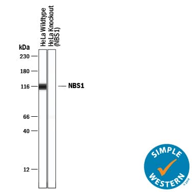 Detection of Human Nbs1 antibody by Simple WesternTM.