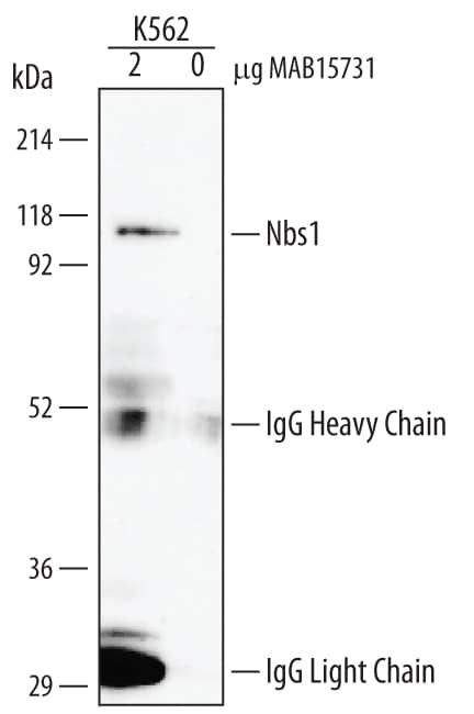 Immunoprecipitation of Human Nbs1.