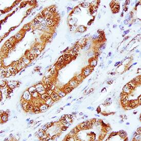 Nectin-3 antibody in Human Kidney Array by Immunohistochemistry (IHC-P).