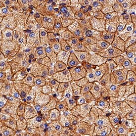 Nectin-2/CD112 antibody in Human Liver by Immunohistochemistry (IHC-P).
