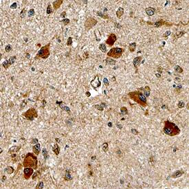 Nesfatin-1/Nucleobindin-2 antibody in Human Brain by Immunohistochemistry (IHC-P).