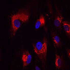 Nesfatin-1/Nucleobindin-2 antibody in Human Mesenchymal Stem Cells by Immunocytochemistry (ICC).