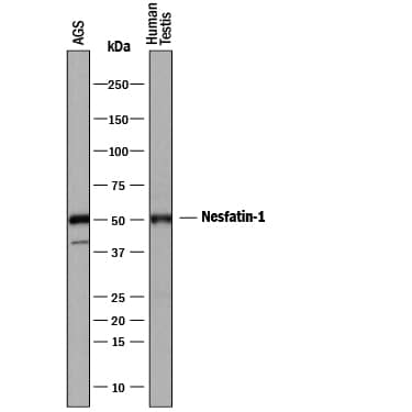 Detection of Human Nesfatin-1/Nucleobindin-2 antibody by Western Blot.