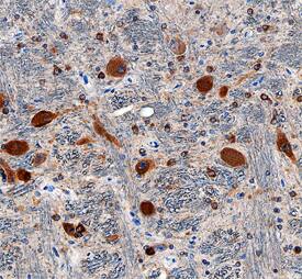 Neudesin antibody in Human Brain by Immunohistochemistry (IHC-P).