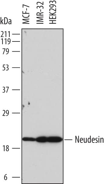 Detection of Human Neudesin antibody by Western Blot.