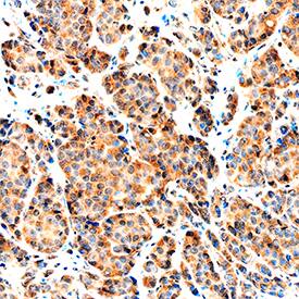 NRG1-beta 1/HRG1-beta 1 antibody in Human Breast by Immunohistochemistry (IHC-P).